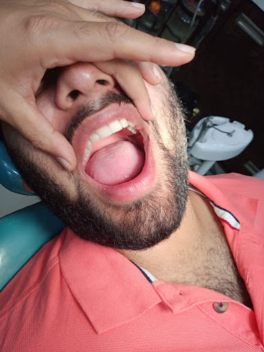 edial